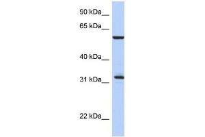 Western Blot showing CDC34 antibody used at a concentration of 1-2 ug/ml to detect its target protein. (CDC34 anticorps  (Middle Region))