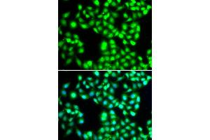 Immunofluorescence analysis of MCF-7 cells using YTHDC1 antibody (ABIN5974420). (YTHDC1 anticorps)