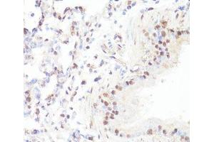 Immunohistochemistry of paraffin-embedded Mouse lung using Phospho-MYC(S62) Polyclonal Antibody at dilution of 1:100 (40x lens).