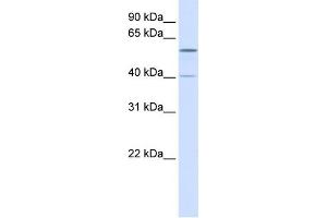 WB Suggested Anti-TRIM49 Antibody Titration:  0. (TRIM49 anticorps  (N-Term))