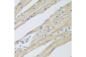 Immunohistochemistry of paraffin-embedded mouse heart using WDR77 antibody at dilution of 1:200 (40x lens). (WDR77 anticorps)