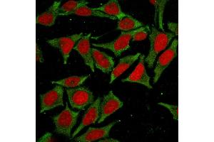 Immunofluorescence Analysis of MeOH-fixed HeLa cells labeling GSTMu2 with GSTMu2 Mouse Monoclonal Antibody (CPTC-GSTMu2-2) followed by Goat anti-Mouse IgG-CF488 (Green).