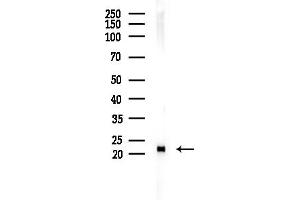 Western blot analysis of lysates from Rat liver, using LOH12CR1 Antibody at 1/1000 dilution.
