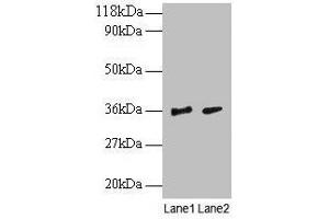 Western blot All lanes: SNRPG antibody at 2 μg/mL Lane 1: EC109 whole cell lysate Lane 2: 293T whole cell lysate Secondary Goat polyclonal to rabbit IgG at 1/15000 dilution Predicted band size: 9 kDa Observed band size: 36 kDa (SNRPG anticorps  (AA 1-76))