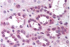 Human Kidney (formalin-fixed, paraffin-embedded) stained with RELA antibody ABIN218582 at 1:500 followed by biotinylated goat anti-rabbit IgG secondary antibody ABIN481713, alkaline phosphatase-streptavidin and chromogen. (NF-kB p65 anticorps  (pSer529))