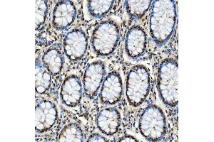 IHC analysis of SNRPD2 using anti-SNRPD2 antibody (ABIN7598963). (SNRPD2 anticorps  (AA 1-118))