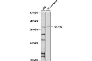 anti-Plexin B1 (PLXNB1) (AA 250-470) antibody