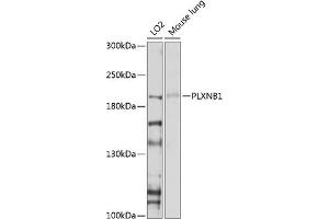 Western blot analysis of extracts of various cell lines, using PLXNB1 antibody (ABIN6129763, ABIN6145806, ABIN6145807 and ABIN6214109) at 1:1000 dilution. (PLXNB1 anticorps  (AA 250-470))