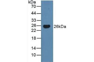 Detection of BMF in Human Serum using Polyclonal Antibody to Bcl2 Modifying Factor (BMF) (BMF anticorps  (AA 1-181))