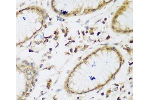 Immunohistochemistry of paraffin-embedded Human gastric using UBE3A Polyclonal Antibody at dilution of 1:200 (40x lens).