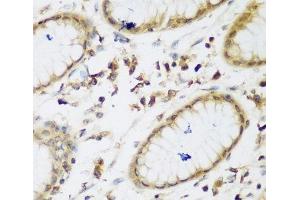 Immunohistochemistry of paraffin-embedded Human gastric using UBE3A Polyclonal Antibody at dilution of 1:200 (40x lens). (ube3a anticorps)