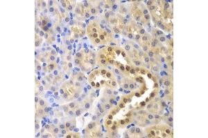 Immunohistochemistry of paraffin-embedded mouse kidney using GLO1 antibody at dilution of 1:200 (400x lens). (GLO1 anticorps)