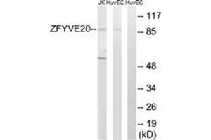 Western blot analysis of extracts from HuvEc/Jurkat cells, using ZFYVE20 Antibody. (Rabenosyn 5 anticorps  (AA 145-194))