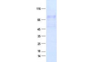 Validation with Western Blot