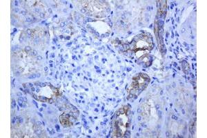 Image no. 5 for anti-ATP-Binding Cassette, Sub-Family B (MDR/TAP), Member 1 (ABCB1) (AA 995-1280) antibody (ABIN1491724)