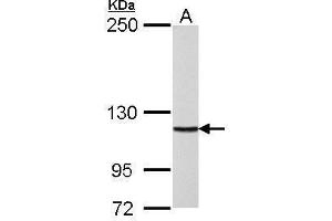 WB Image DNA polymerase delta antibody detects POLD1 protein by Western blot analysis.