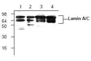 Image no. 1 for anti-Lamin A/C (LMNA) antibody (ABIN127068) (Lamin A/C anticorps)