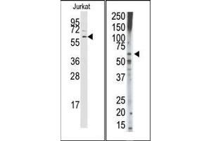 Image no. 1 for anti-Transforming Growth Factor, beta Receptor 1 (TGFBR1) (Middle Region) antibody (ABIN360163)