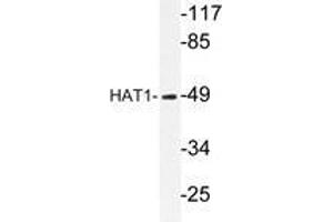 Western blot analysis of HAT1 antibody in extracts from LOVO cells. (HAT1 anticorps)