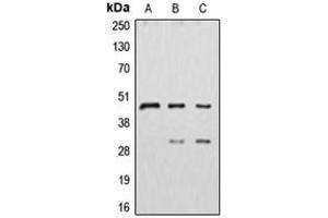 Western blot analysis of Cathepsin D expression in HepG2 (A), MDAMB231 (B), MCF7 (C) whole cell lysates. (Cathepsin D anticorps  (Center))