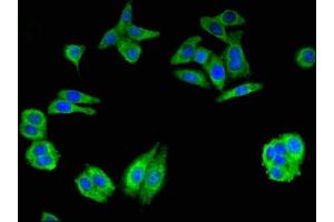 Immunofluorescent analysis of HepG2 cells using ABIN7154002 at dilution of 1:100 and Alexa Fluor 488-congugated AffiniPure Goat Anti-Rabbit IgG(H+L)