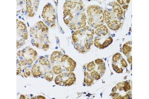 Immunohistochemistry of paraffin-embedded Human stomach using HDAC6 Polyclonal Antibody at dilution of 1:100 (40x lens). (HDAC6 anticorps)