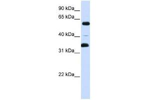 Western Blot showing ZKSCAN1 antibody used at a concentration of 1-2 ug/ml to detect its target protein. (ZKSCAN1 anticorps  (Middle Region))