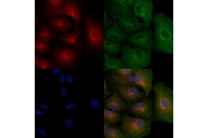 ABIN6256960 and ABIN6274918 staining  cells by IF/ICC. (BMP10 anticorps  (Internal Region))