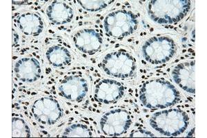 Image no. 2 for anti-TYRO3 Protein Tyrosine Kinase (TYRO3) antibody (ABIN1501608)