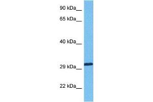 Host:  Rabbit  Target Name:  RBM7  Sample Tissue:  Human Lung Tumor  Antibody Dilution:  1ug/ml
