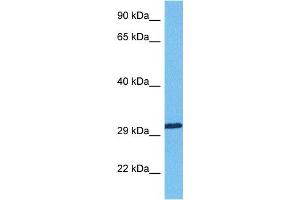 Host:  Rabbit  Target Name:  RBM7  Sample Tissue:  Human Lung Tumor  Antibody Dilution:  1ug/ml (RBM7 anticorps  (Middle Region))