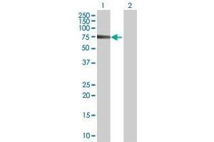 Lane 1: MTM1 transfected lysate ( 66. (MTM1 293T Cell Transient Overexpression Lysate(Denatured))