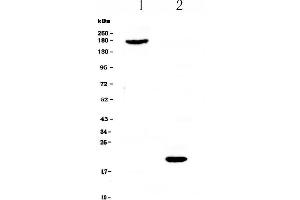Western blot analysis of COL18A1 using anti-COL18A1 antibody . (COL18A1 anticorps  (AA 1572-1754))