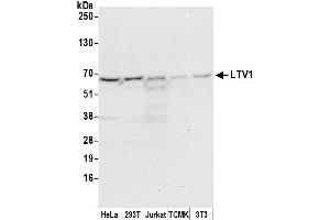 anti-LTV1 Homolog (LTV1) (AA 125-175) antibody
