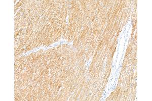 Immunohistochemistry (IHC) image for anti-Troponin I (TNNI) (AA 1-50) antibody (ABIN7795680)