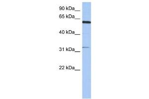 CDKL2 antibody used at 1 ug/ml to detect target protein.