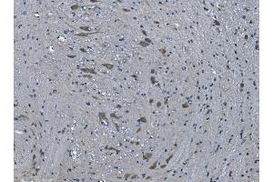 IHC analysis of TMPRSS3 using anti-TMPRSS3 antibody (ABIN7601198). (TMPRSS3 anticorps  (AA 3-454))