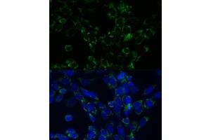 Immunofluorescence analysis of NIH-3T3 cells using GLUD1 antibody (ABIN6127975, ABIN6141157, ABIN6141158 and ABIN6223546) at dilution of 1:100.