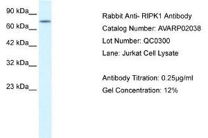 WB Suggested Anti-RIPK1  Antibody Titration: 0. (RIPK1 anticorps  (Middle Region))