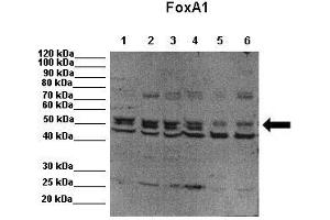 WB Suggested Anti-FOXA1 Antibody  Positive Control: Lane 1: 20ug MCF7 cell lysates Lane 2: 20ug MCF7 cell lysates Lane 3: 20ug MCF7 cell lysates Lane 4: 20ug MCF7 cell lysates Lane 5: 20ug MCF7 with FoxA1 knockdown Lane 6: 20ug MCF7 with FoxA1 knockdown  Primary Antibody Dilution :  1:1000 Secondary Antibody : Anti-rabbit-HRP  Secondry Antibody Dilution :  1:2000 Submitted by: Fu, Xiaoyong, Baylor College of Medicine FOXA1 is supported by BioGPS gene expression data to be expressed in MCF7