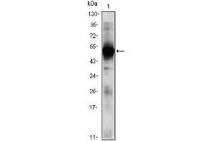 Western Blot showing RAG2 antibody used against RAG2 (AA: 350-527)-hIgGFc transfected HEK293 (1)cell lysate. (RAG2 anticorps  (AA 350-527))