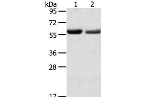 Western Blot analysis of Human normal stomach and stomach cancer tissue using SLC16A9 Polyclonal Antibody at dilution of 1:200 (SLC16A9 anticorps)