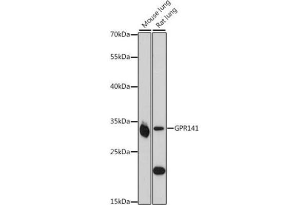GPR141 抗体  (AA 50-150)