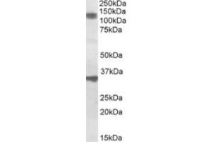 Western Blotting (WB) image for anti-Cell Division Cycle and Apoptosis Regulator 1 (CCAR1) (Internal Region) antibody (ABIN2464383) (CCAR1 anticorps  (Internal Region))