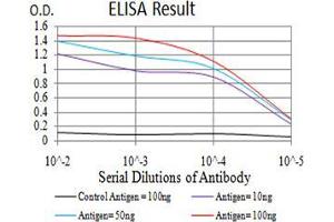 Black line: Control Antigen (100 ng);Purple line: Antigen (10ng); Blue line: Antigen (50 ng); Red line:Antigen (100 ng)