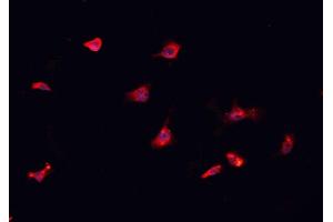 ABIN6276962 staining HepG2? (CD151 anticorps  (N-Term))