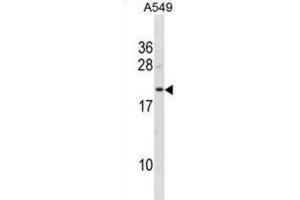 Western Blotting (WB) image for anti-Flavin Reductase (BLVRB) antibody (ABIN3001274) (BLVRB anticorps)