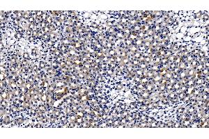 Detection of TIRAP in Mouse Kidney Tissue using Polyclonal Antibody to Toll Interleukin 1 Receptor Domain Containing Adaptor Protein (TIRAP)