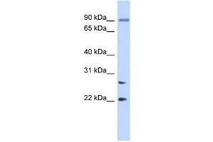 WB Suggested Anti-JOSD2 Antibody Titration: 0. (JOSD2 anticorps  (N-Term))