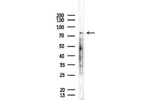 anti-DNA Cross-Link Repair 1C (DCLRE1C) (C-Term) antibody